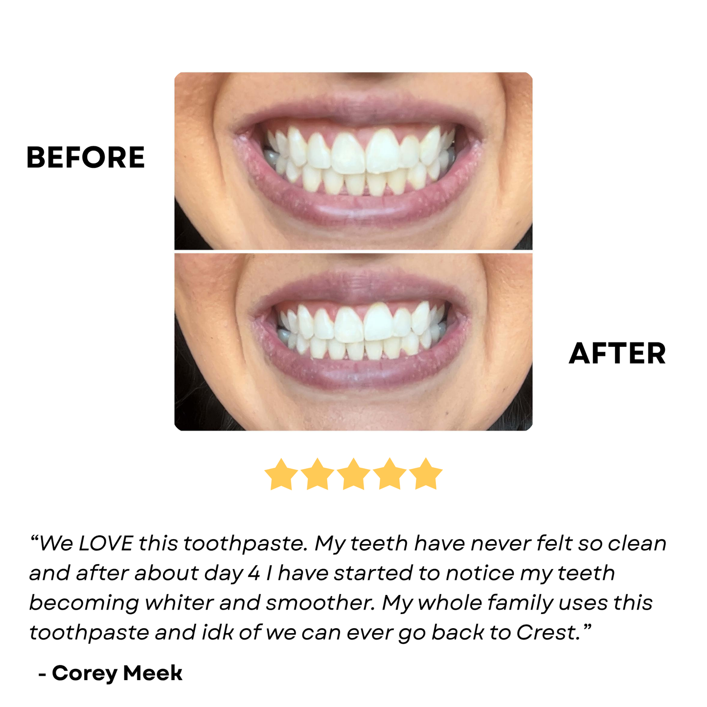 Hydroxyapatite Toothpaste | BOGO Sale